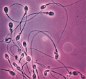 Spermiji gledani svjetlosnim mikroskopom